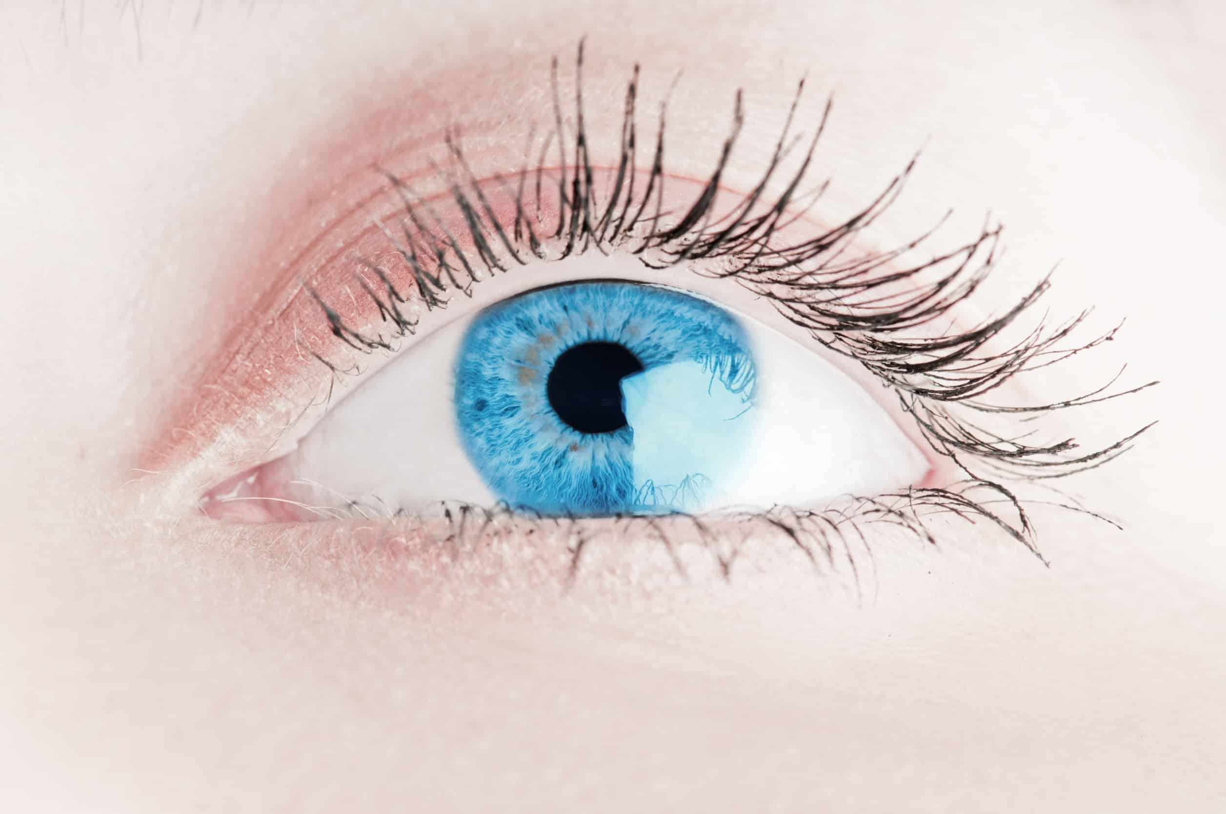 Secheresse oculaire remede grand mere - crédits 123rf.com