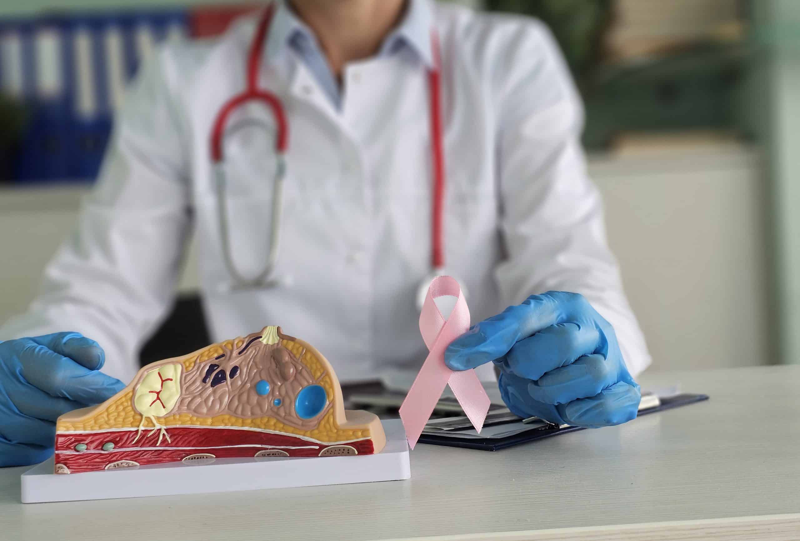 Taux de CRP et cancer