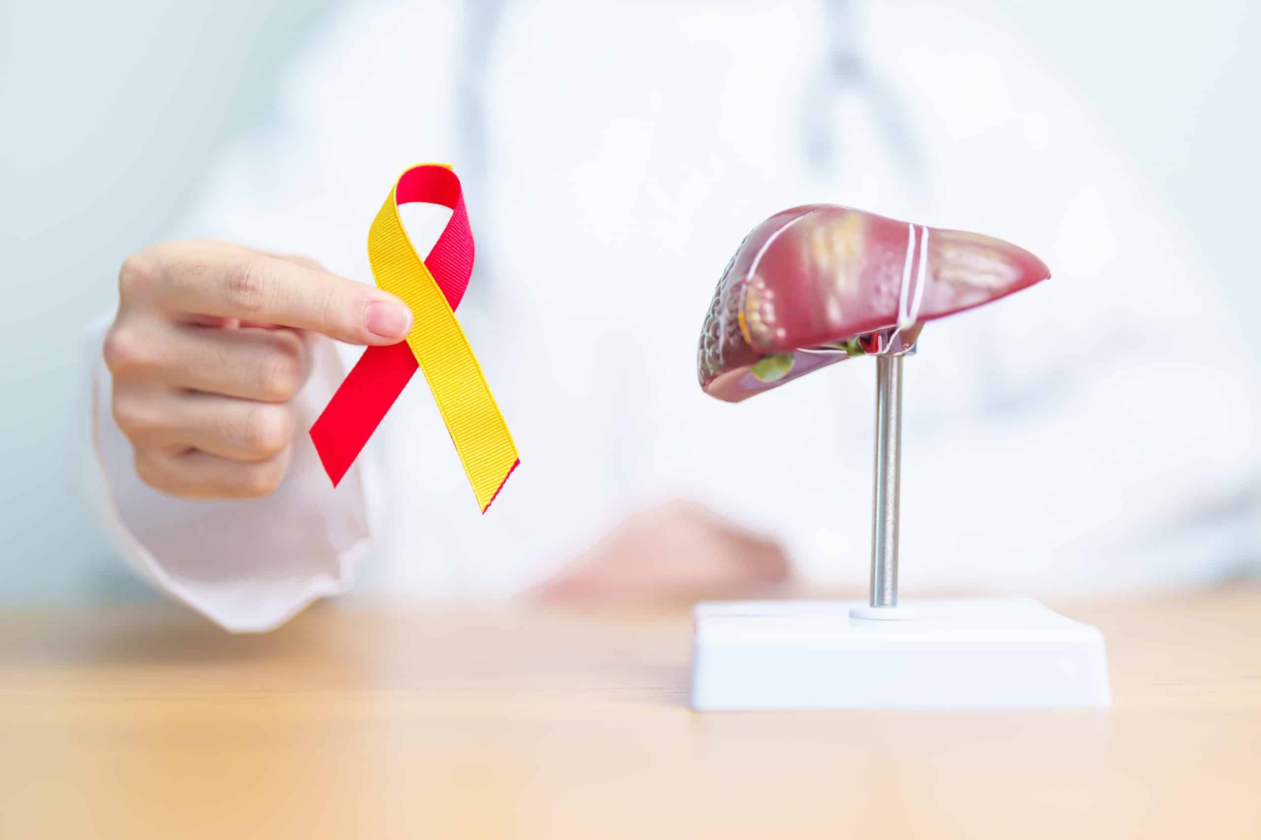 Taux de bilirubine et cancer