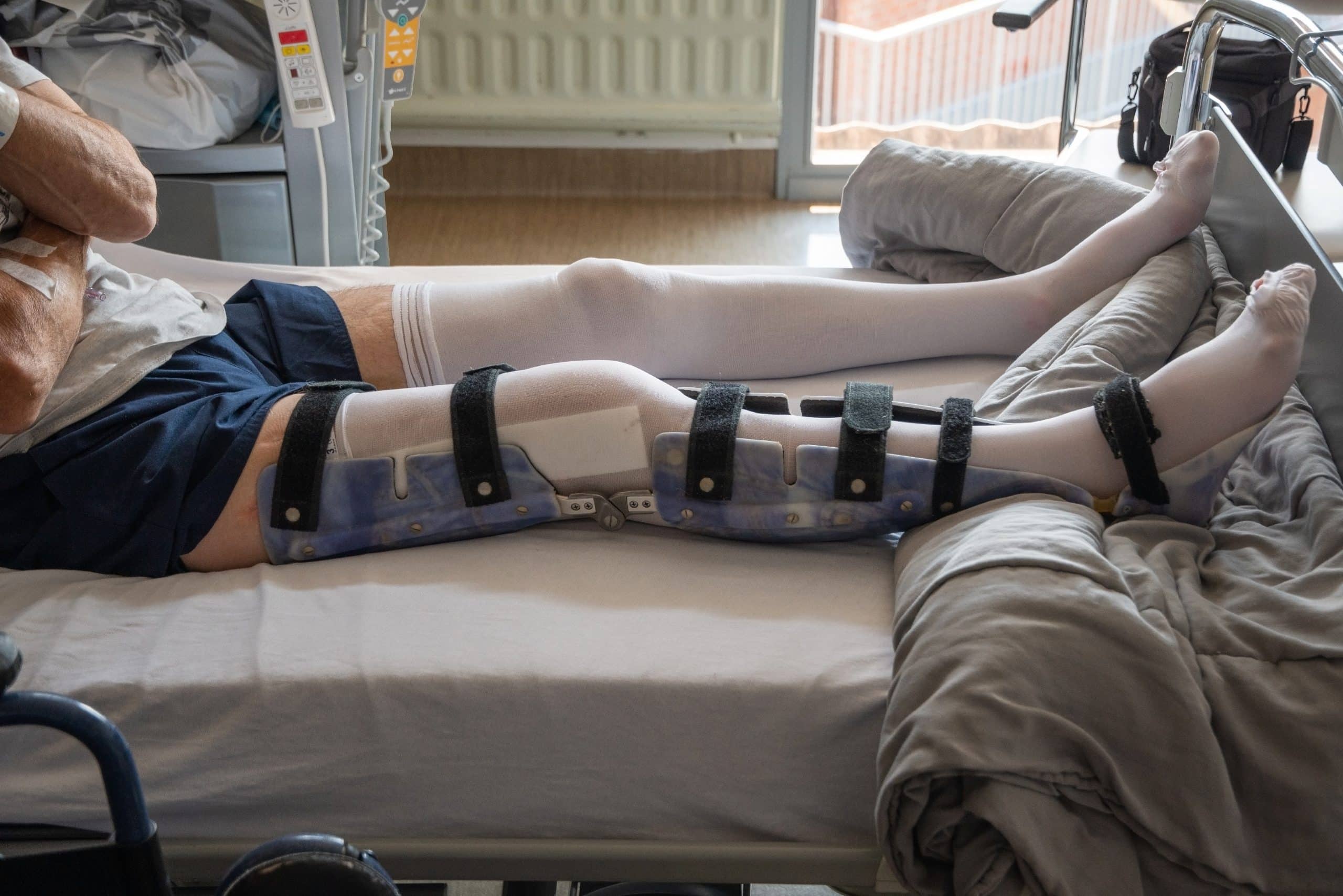 Fracture du fémur durée hospitalisation