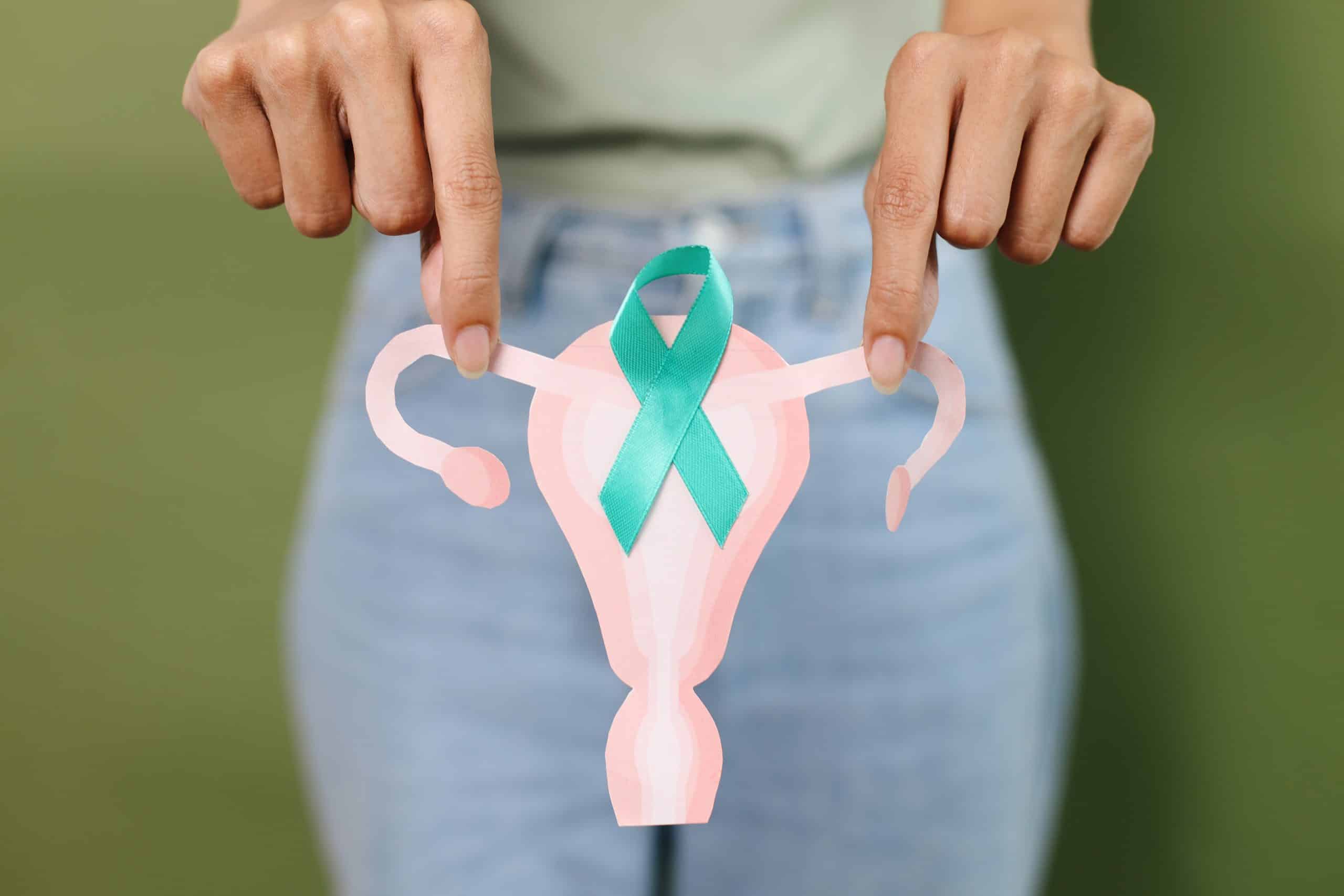 En combien de temps se développe un cancer des ovaires