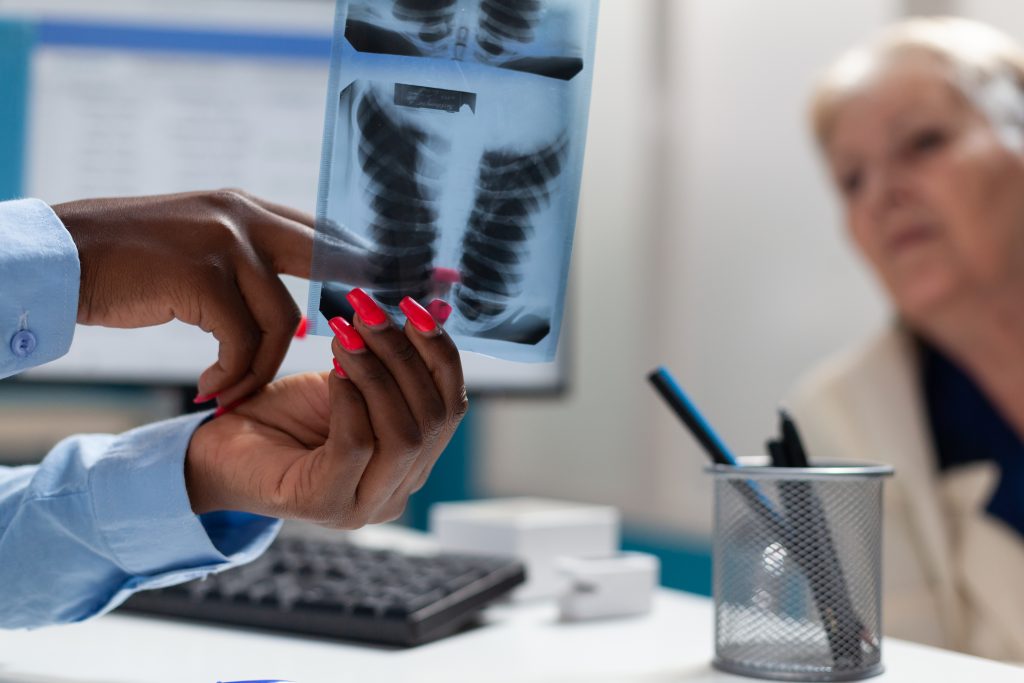 Cancer des os phase terminale