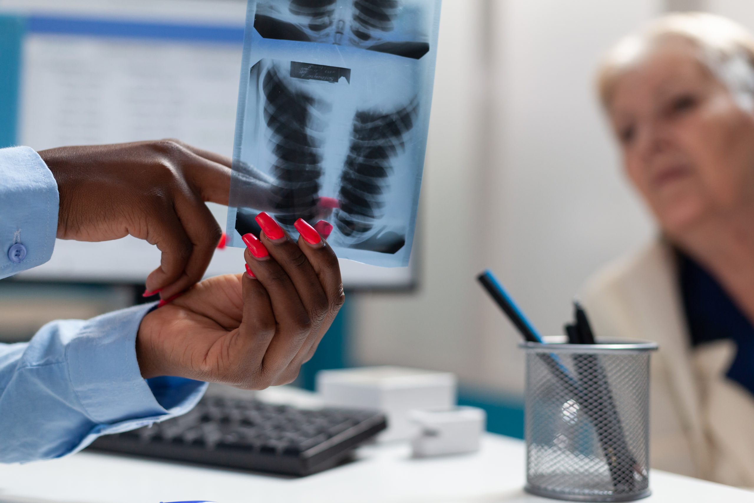 Cancer des os phase terminale