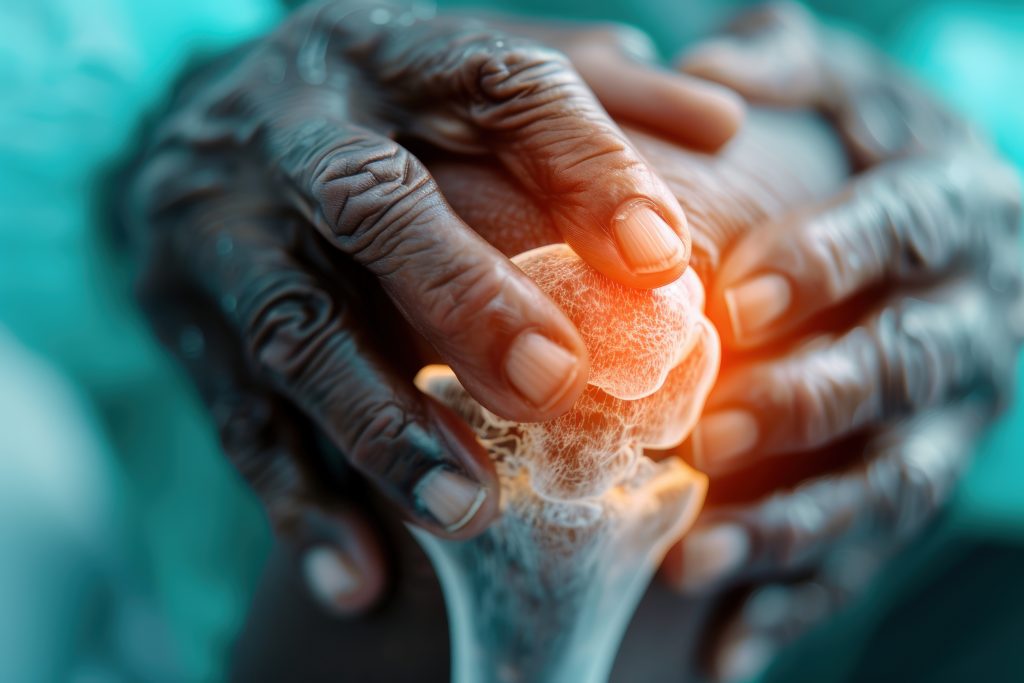 Phase Terminale Cancer des Os - Phase Terminale Cancer des Os - Phase Terminale Cancer des Os